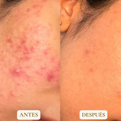 TOALLA EXFOLIANTE - ELIMINA GRANOS Y TEXTURA