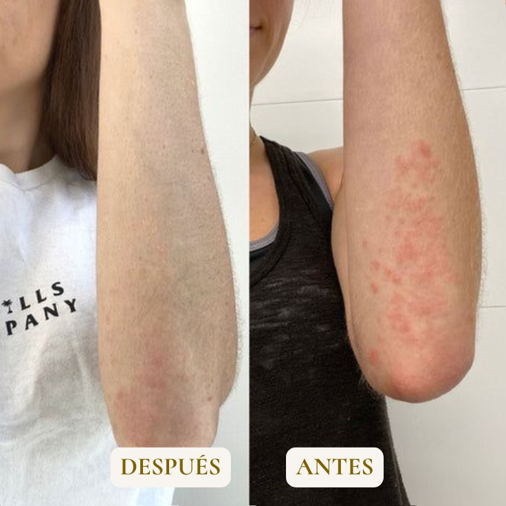 TOALLA EXFOLIANTE - ELIMINA GRANOS Y TEXTURA