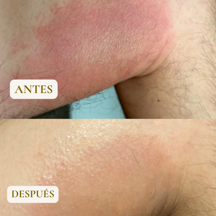 TOALLA EXFOLIANTE - ELIMINA GRANOS Y TEXTURA