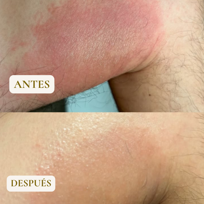 TOALLA EXFOLIANTE - ELIMINA GRANOS Y TEXTURA